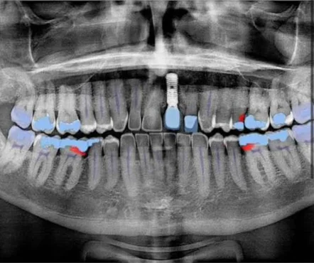 Second annotated 3D scan screenshot