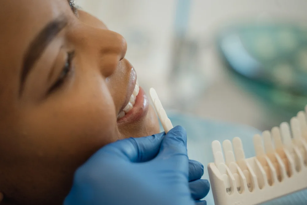 Composite shade matching for cosmetic bonding at mend dental