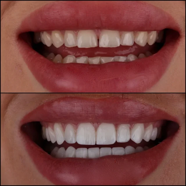 Cosmetic Dentistry