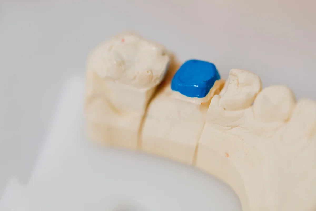 A dental crown held in a clean container