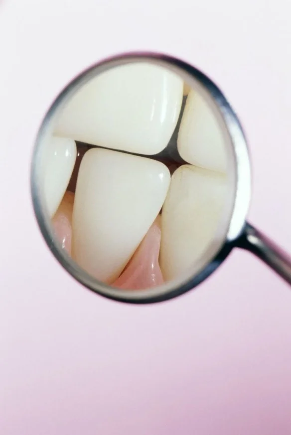 Deep teeth cleaning with hygienist Frank Harant at mend dental in Irvine, CA