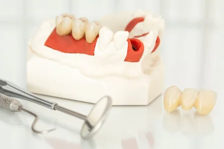 Before and after a ceramic dental crown at mend dental