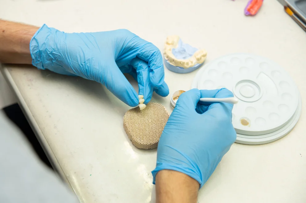 Dental implant consultation with 3D imaging at mend dental in Irvine, CA