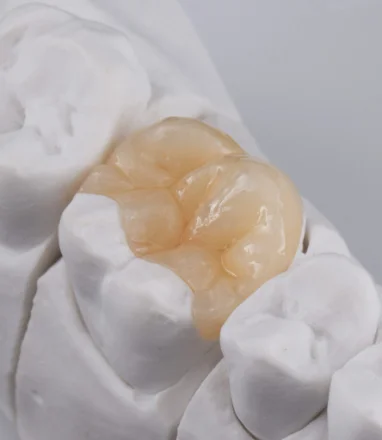 Before and after a ceramic dental crown at mend dental