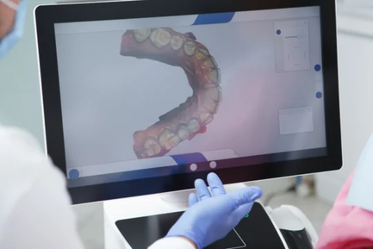 Digital smile design preview on screen at mend dental