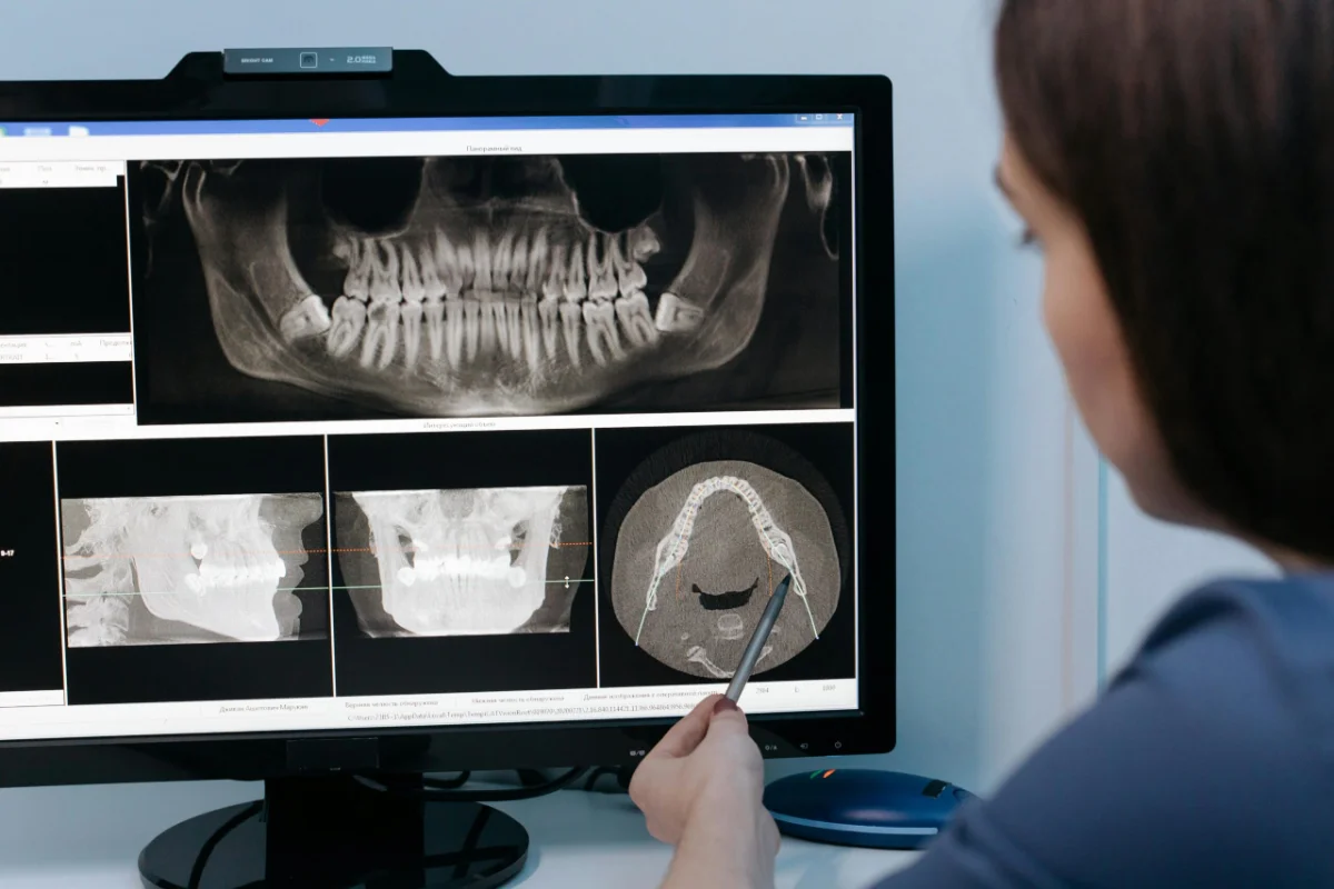 Dr. Monique Sison reviewing a 3D dental scan with a patient at mend dental in Irvine