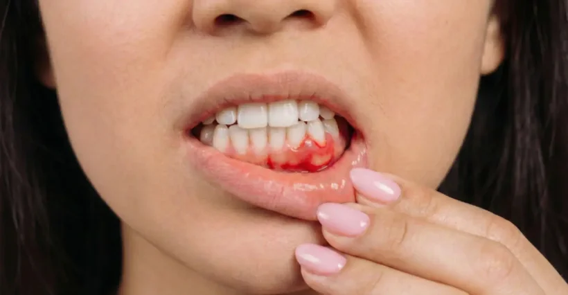 Hygienist checking a patient's gums at mend dental in Irvine, CA