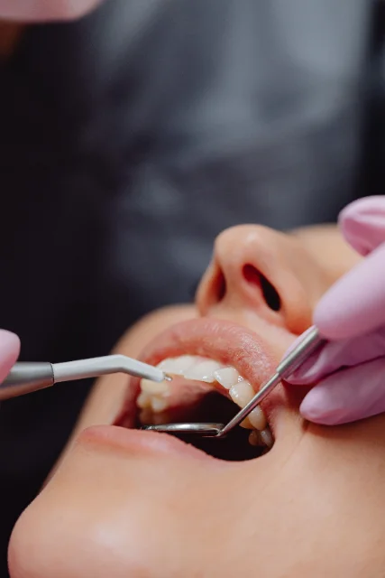 Gum Disease Treatment