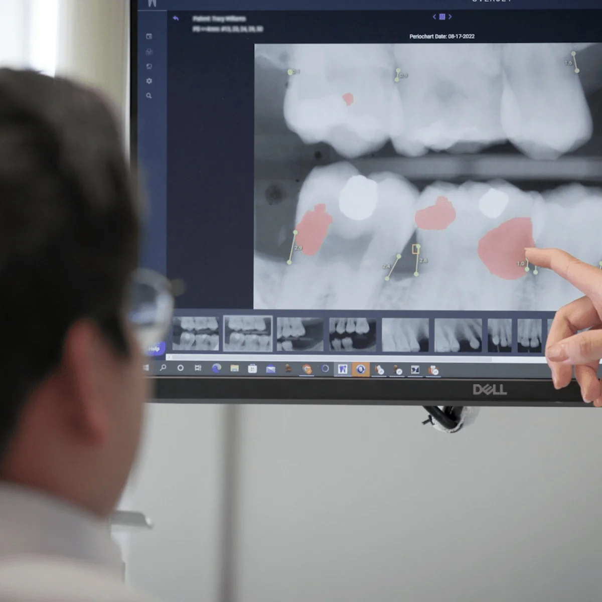 Dr. Sison explaining a scan to a patient, no pressure