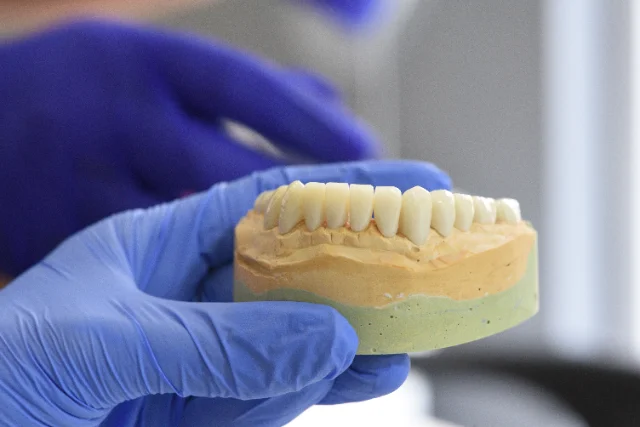 Dental Crowns