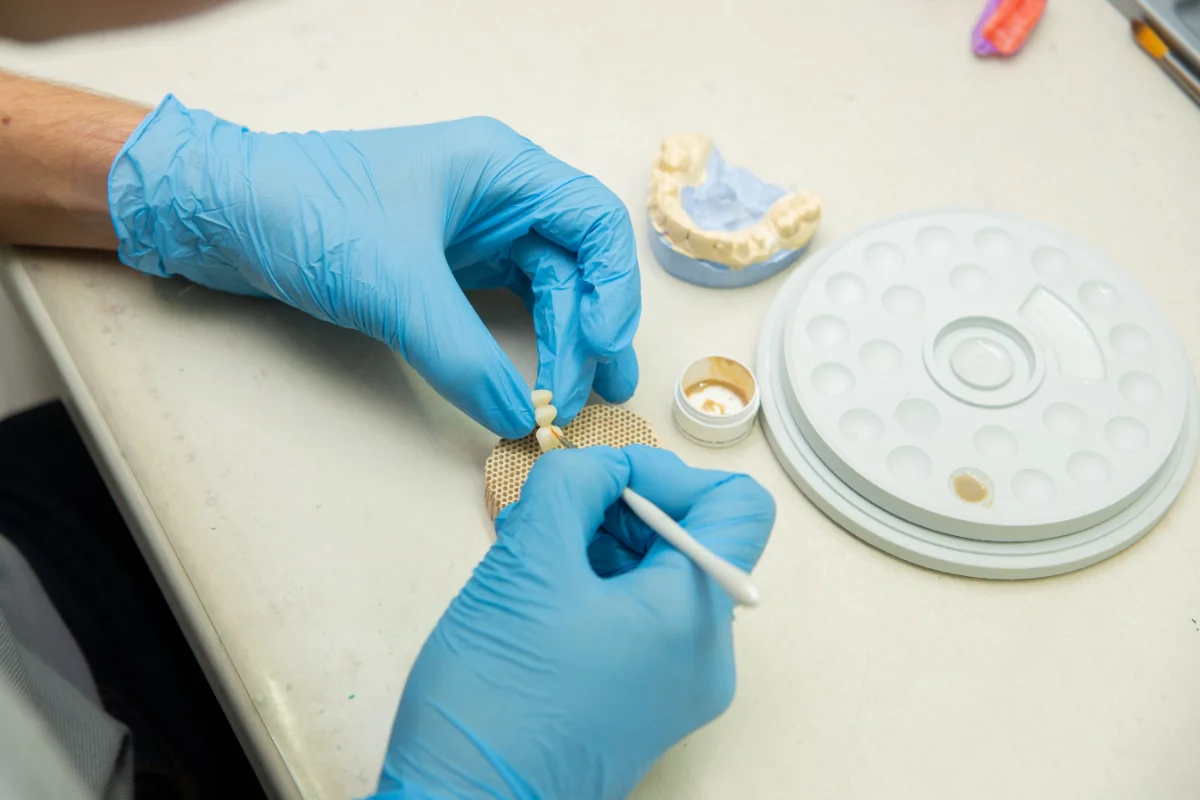 Implant and bridge models side by side on a tray