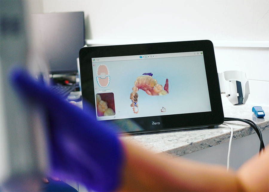 3D scan on screen