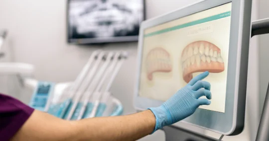 iTero Lumina intraoral scanner used for 3D dental scans at mend dental