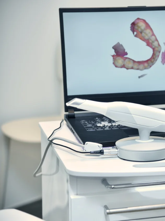 Digital 3D scan for a dental bridge at mend dental