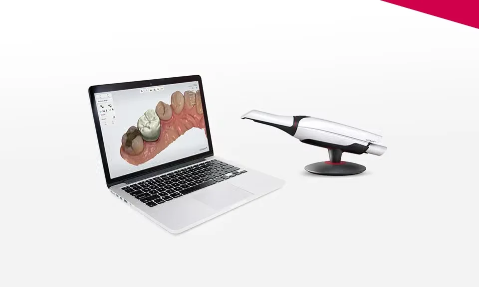 Digital 3D scan for a dental crown at mend dental