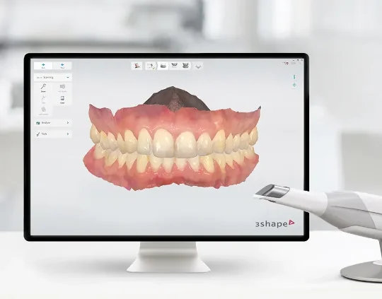 iTero 3D scan for Invisalign at mend dental