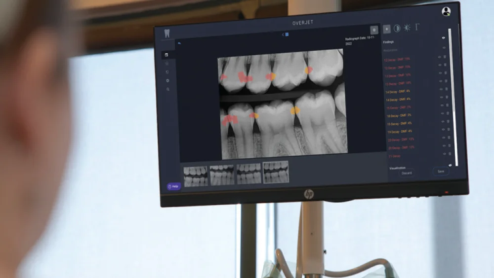 Low-dose digital dental X-ray at mend dental in Irvine