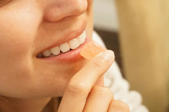mend dental patient smiling after KöR whitening in Irvine