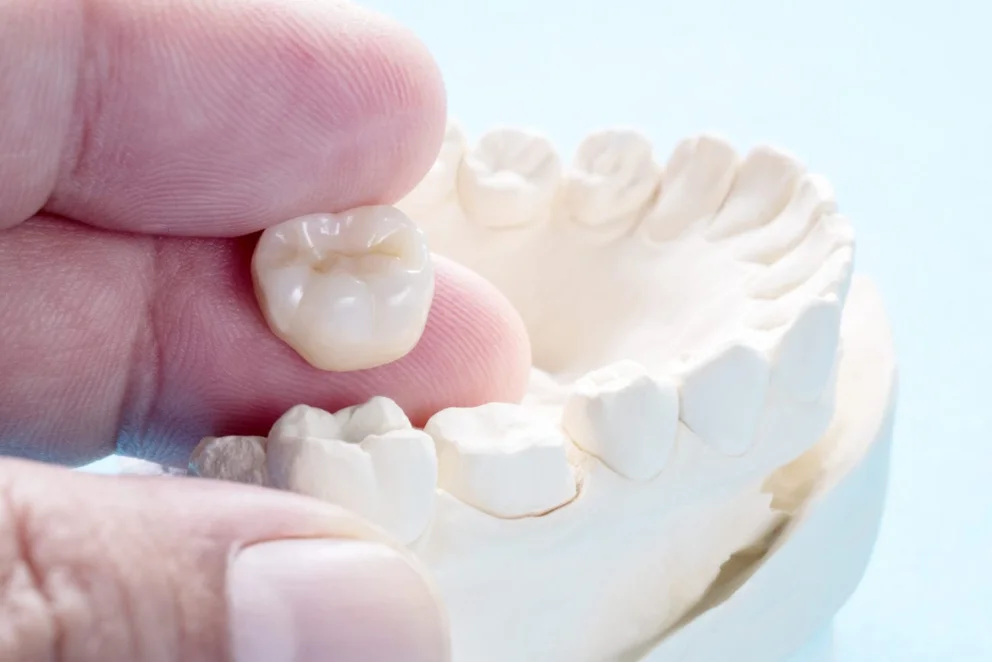 Restorative dentistry consultation at mend dental in Irvine, CA