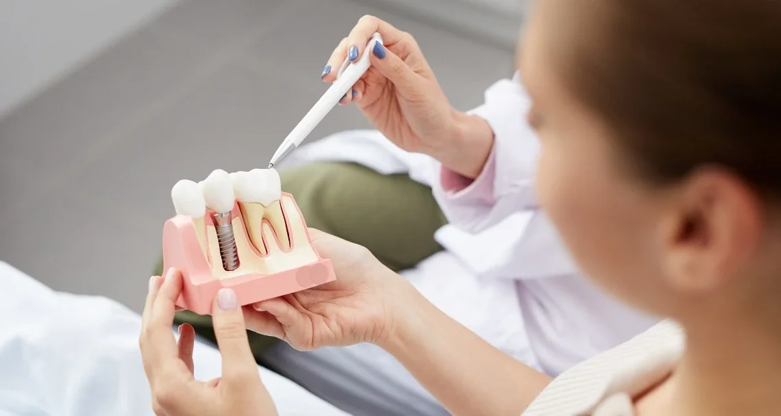 Dental implants at mend dental