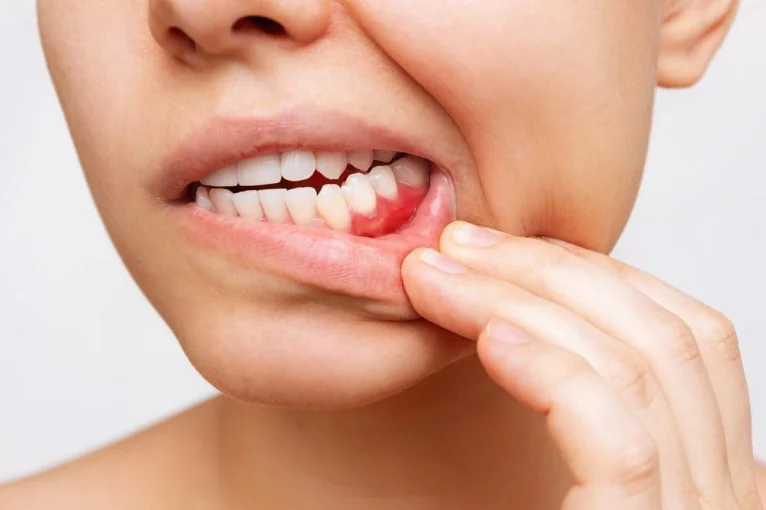 Toothache, emergency dental care at mend dental in Irvine
